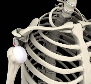 SHOULDER INSTABILITY